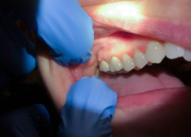 Best Same-Day Emergency Dental Services in Harrison, MI