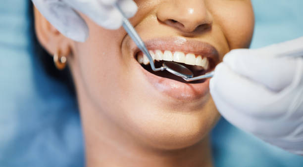 Best Emergency Dental Care for Broken or Chipped Teeth in Harrison, MI