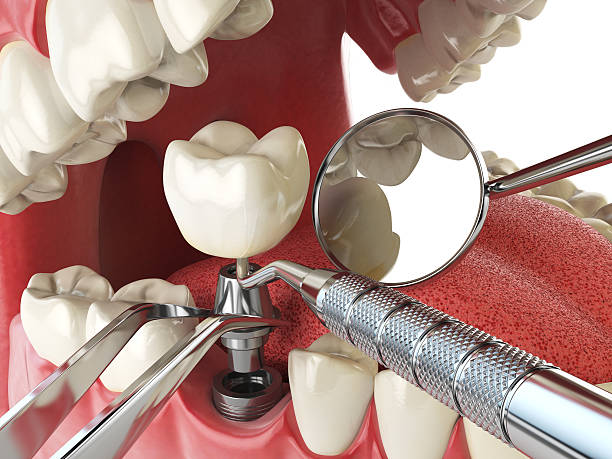 Best After-Hours Dental Trauma Care in Harrison, MI